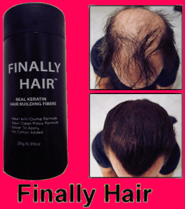 female hair loss