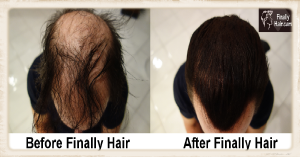 Finally Hair Before After 1200x627 for yahoo