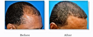 ethnic hair loss